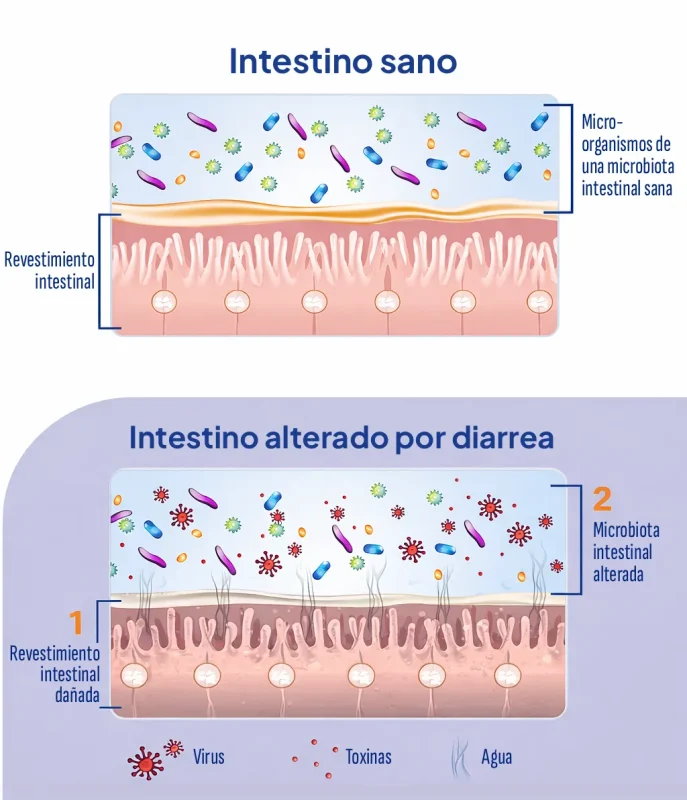 Infografía del intestino sano y del intestino alterado por diarrea